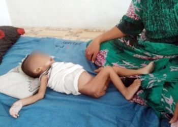 Muhammad Erkhan, Bayi Berusia 10 Bulan di Mandailing Natal Meninggal Akibat Gizi Buruk