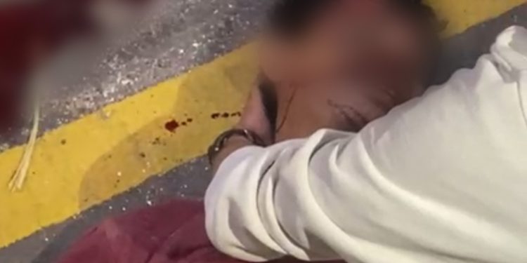 Pria Asal Atambua NTT Ditemukan Meninggal Akibat Kecelakaan Tunggal di Baypass Ngurah Rai